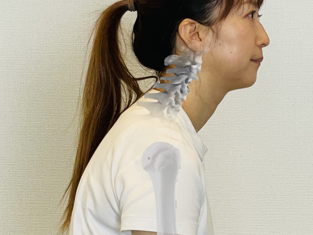 ストレートネック解消の重要性